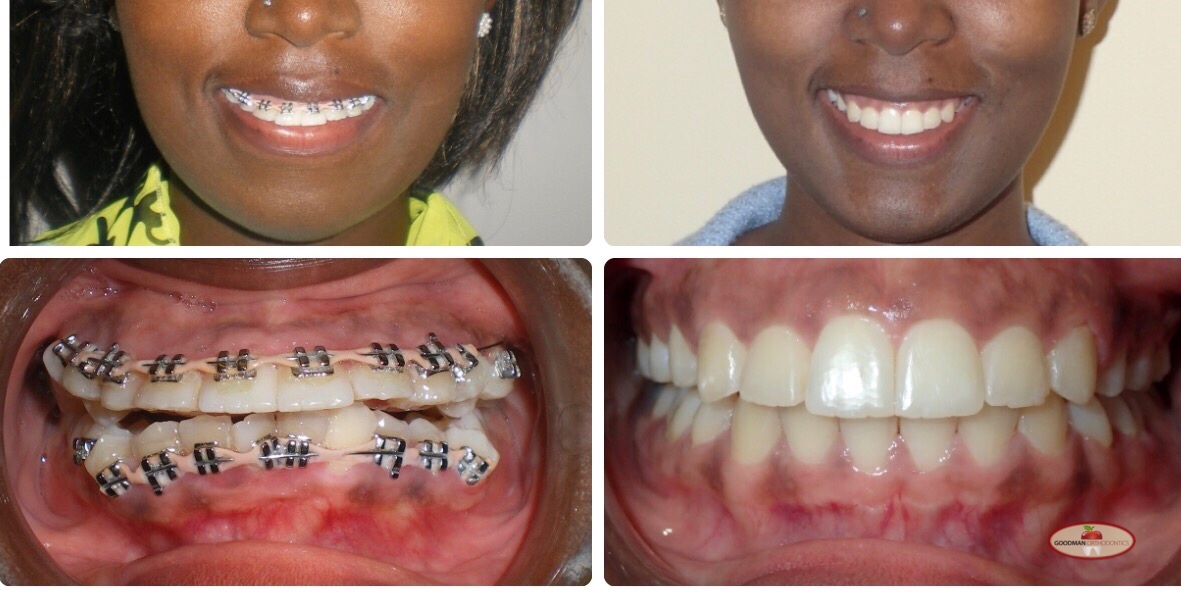 Goodman Orthodontics