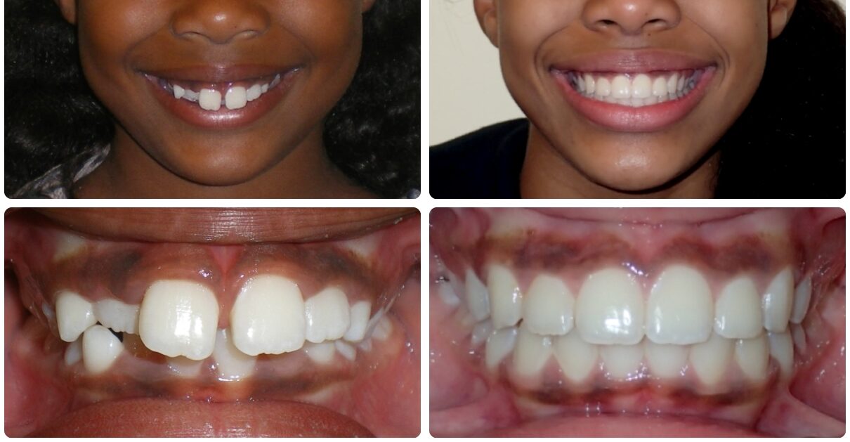 Goodman Orthodontics